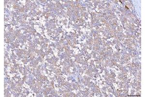 IHC analysis of EIF5A using anti-EIF5A antibody (ABIN7602568). (EIF5A antibody  (AA 86-154))