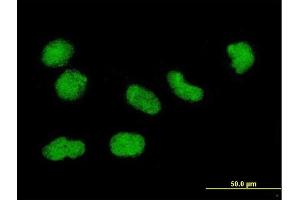 Immunofluorescence of monoclonal antibody to H3F3B on HeLa cell. (H3F3B antibody  (AA 1-136))