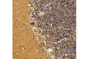 IHC analysis of DNM3 using anti-DNM3 antibody (ABIN7601163). (Dynamin 3 antibody  (AA 295-712))