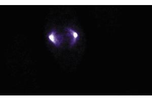 Immunofluorescence staining of human endothelial cells. (Aurora A antibody  (AA 8-116))
