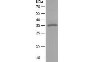 Western Blotting (WB) image for Nuclear Factor of kappa Light Polypeptide Gene Enhancer in B-Cells Inhibitor, delta (NFKBID) (AA 1-313) protein (His tag) (ABIN7287991) (NFKBID Protein (AA 1-313) (His tag))