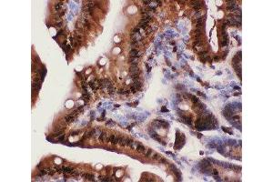 IHC-P: Caspase-3 antibody testing of mouse intestine tissue (Caspase 3 antibody  (AA 67-175))