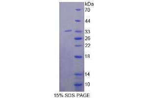 SDS-PAGE analysis of Mouse ABAT Protein.