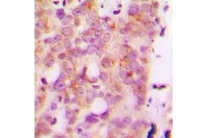 Immunohistochemistry (IHC) image for anti-Major Histocompatibility Complex, Class I, H (Pseudogene) (HLA-H) (Center) antibody (ABIN7300828)