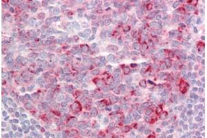 Human Tonsil: Formalin-Fixed, Paraffin-Embedded (FFPE) (TSHZ1 antibody  (N-Term))