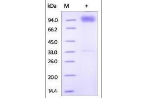 SDS-PAGE (SDS) image for Interleukin 18 Receptor 1 (IL18R1) (AA 19-329) protein (Fc Tag) (ABIN2181354) (IL18R1 Protein (AA 19-329) (Fc Tag))