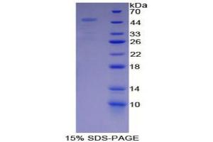 SDS-PAGE (SDS) image for Proteasome (Prosome, Macropain) 26S Subunit, Non-ATPase, 13 (PSMD13) (AA 1-378) protein (His tag) (ABIN2126479) (PSMD13 Protein (AA 1-378) (His tag))