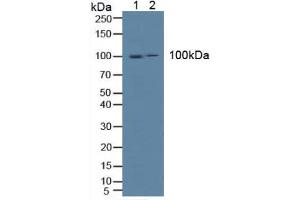 Figure. (ICAM1 antibody  (AA 102-306))