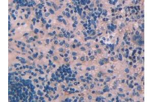 DAB staining on IHC-P; Samples: Rat Spleen Tissue (PLA2G2D antibody  (AA 20-134))