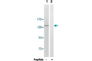 Western blot analysis of extracts from COLO 205 cells, using CEP135 polyclonal antibody . (CEP135 antibody  (C-Term))