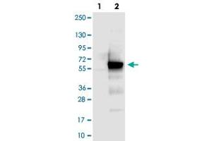 Western blot analysis of Lane 1: Negative control (vector only transfected HEK293T lysate), Lane 2: Over-expression Lysate (Co-expressed with a C-terminal myc-DDK tag (~3. (CCDC97 antibody)