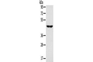 Western Blotting (WB) image for anti-Monocarboxylate Transporter 3 (MCT3) antibody (ABIN2433813) (MCT3 antibody)