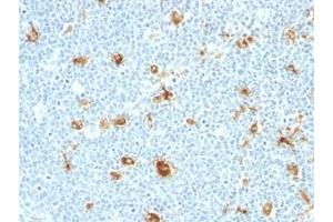 Formalin-fixed, paraffin-embedded human tonsil stained with Calgranulin A + B antibody (CAGB/426) (S100A8/A9 Complex (Calprotectin) antibody)