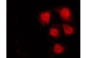 ABIN6272615 staining A549 by IF/ICC. (CDK17 antibody  (Internal Region))