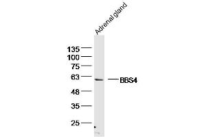 Mouse adrenal gland lysates probed with BBS4 Polyclonal Antibody, unconjugated  at 1:300 overnight at 4°C followed by a conjugated secondary antibody for 60 minutes at 37°C. (BBS4 antibody  (AA 431-519))