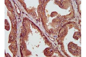 IHC image of ABIN7158882 diluted at 1:400 and staining in paraffin-embedded human prostate tissue performed on a Leica BondTM system. (MIF antibody  (AA 2-115))