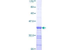 Image no. 1 for BCL2-Associated X Protein (BAX) (AA 1-100) protein (GST tag) (ABIN1346448) (BAX Protein (AA 1-100) (GST tag))