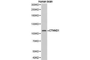 Western Blotting (WB) image for anti-Catenin (Cadherin-Associated Protein), delta 1 (CTNND1) antibody (ABIN1872087) (CTNND1 antibody)