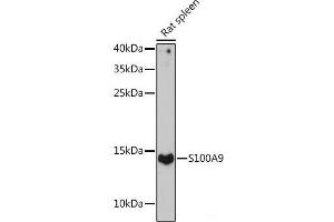 Western blot analysis of extracts of Rat spleen using S100A9 Polyclonal Antibody at dilution of 1:1000. (S100A9 antibody)
