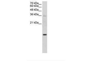 Image no. 1 for anti-Ubiquitin-Conjugating Enzyme E2D 2 (UBE2D2) (AA 91-140) antibody (ABIN203474) (UBE2D2 antibody  (AA 91-140))