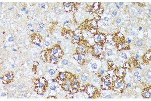 Immunohistochemistry of paraffin-embedded Rat liver using WNT1 Polyclonal Antibody at dilution of 1:100 (40x lens). (WNT1 antibody)