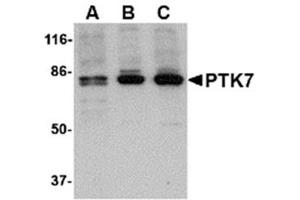 Image no. 1 for anti-PTK7 Protein tyrosine Kinase 7 (PTK7) (N-Term) antibody (ABIN318893)