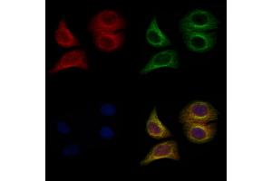 ABIN6266431 and ABIN6267067 staining Hela cells by IF/ICC.