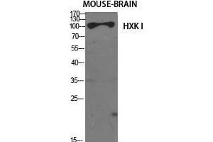 Western Blot (WB) analysis of specific cells using HXK I Polyclonal Antibody. (HXK I (N-Term) antibody)