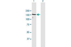 Western Blot analysis of UACA expression in transfected 293T cell line by UACA MaxPab polyclonal antibody. (UACA antibody  (AA 1-1416))