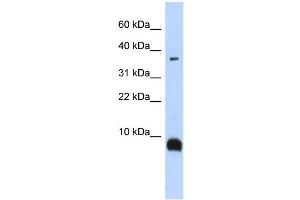 WB Suggested Anti-TAC3 Antibody Titration:  0. (Tachykinin 3 antibody  (Middle Region))