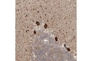 Immunohistochemical staining of human cerebellum with DNAH14 polyclonal antibody  shows strong cytoplasmic positivity in Purkinje cells. (DNAH14 antibody)