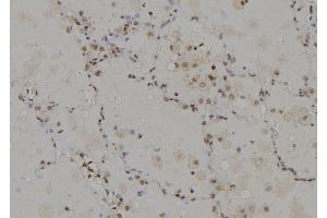 ABIN6274946 at 1/100 staining Human lung tissue by IHC-P. (CAGE1 antibody  (C-Term))