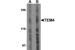 Western blot analysis of TEM4 in Jurkat Cell lysate with TEM4 antibody at (A) 1 and (B) 2 µg/ml. (ARHGEF17 antibody)