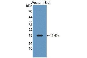 Western blot analysis of the recombinant protein. (DR3/LARD antibody  (AA 38-167))