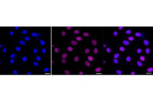 Immunocytochemical staining of HT- cells with EPH receptor B1 antibody (ABIN7798455), 1:1,000). (Recombinant EPH Receptor B1 antibody)