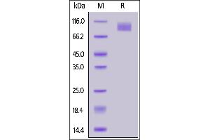 SARS-CoV-2 S2 protein (T1027I, V1176F), His Tag on  under reducing (R) condition.