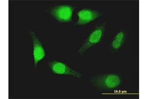 Immunofluorescence of monoclonal antibody to FOXO1 on HeLa cell. (FOXO1 antibody  (AA 452-555))
