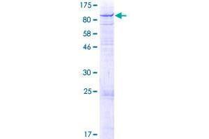GLB1L Protein (AA 1-654) (GST tag)