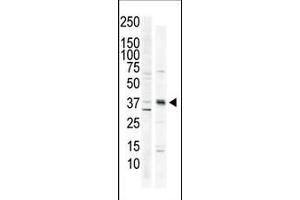 The anti-CK1 C-term Pab (ABIN391310 and ABIN2841344) is used in Western blot to detect CK1 in HeLa cell lysate (lane 1) and primate brain tissue lysate (lane 2). (CAMK1 antibody  (C-Term))