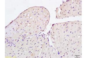 Formalin-fixed and paraffin embedded rat heart tissue labeled with Anti-CIDEC Polyclonal Antibody, Unconjugated (ABIN872596) at 1:200 followed by conjugation to the secondary antibody and DAB staining (CIDEC antibody  (AA 101-200))