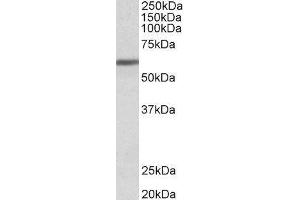 Western Blotting (WB) image for Zinc Finger Protein 703 (ZNF703) peptide (ABIN369017) (Zinc Finger Protein 703 (ZNF703) Peptide)