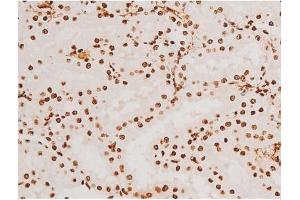 ABIN6267523 at 1/200 staining Rat kidney tissue sections by IHC-P. (SYK antibody  (pTyr348))