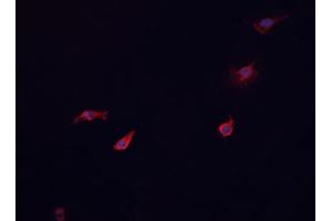 ABIN6268866 staining HeLa cells by IF/ICC. (Glucagon Receptor antibody  (Internal Region))