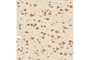 Immunohistochemistry (Paraffin-embedded Sections) (IHC (p)) image for anti-Ubiquitin Protein Ligase E3A (ube3a) antibody (ABIN7076105)