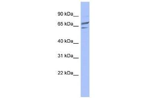 PGM1 antibody used at 1 ug/ml to detect target protein. (Phosphoglucomutase 1 antibody  (Middle Region))