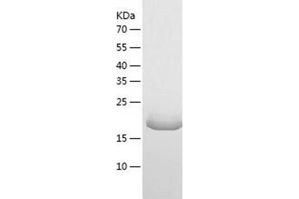 RPS5 Protein (AA 1-204) (His tag)