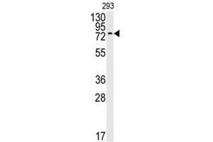 Image no. 1 for anti-Bone Morphogenetic Protein Receptor 1A (BMPR1A) (N-Term) antibody (ABIN357374) (BMPR1A antibody  (N-Term))