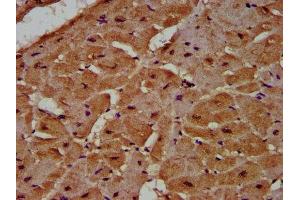 IHC image of ABIN7148294 diluted at 1:500 and staining in paraffin-embedded human heart tissue performed on a Leica BondTM system. (MCC antibody  (AA 479-611))