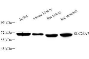 Western blot analysis of SLC26A7 (ABIN7075670) at dilution of 1: 1000 (SLC26A7 antibody)