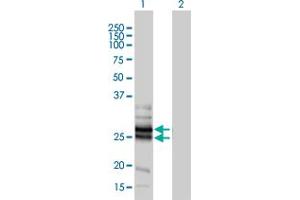 Western Blotting (WB) image for anti-Gap Junction Protein, beta 4, 30.3kDa (GJB4) (AA 1-266) antibody (ABIN566792)